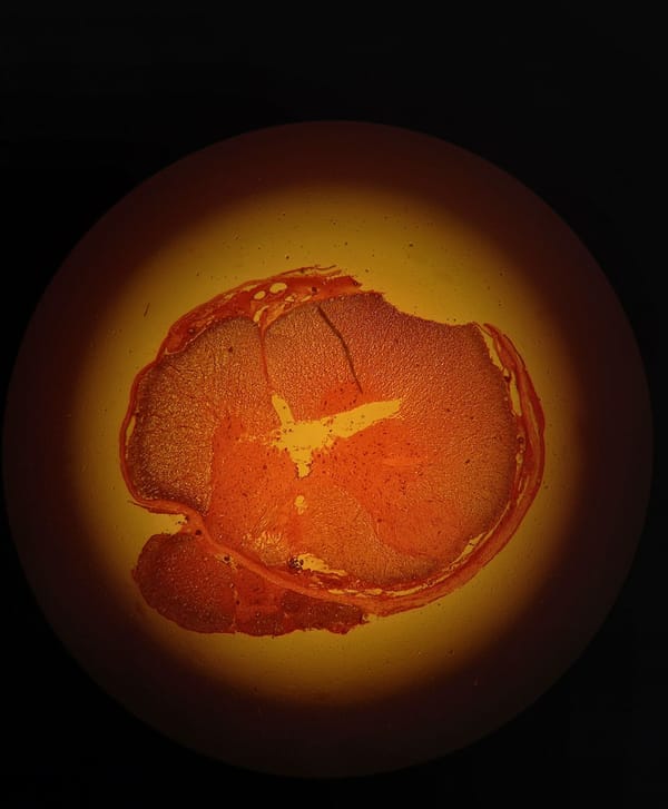 Why Your Waistline Expands With Age: The Newly Found Stem Cell Driving Belly Fat Growth