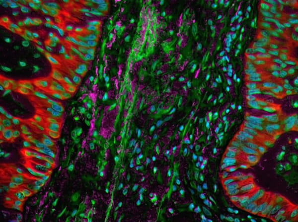 Can Humans Regrow Limbs? New Study Shows Mammals Have Dormant Regenerative Abilities